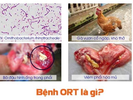 Tìm hiểu bệnh ORT và cách điều trị tại Daga388