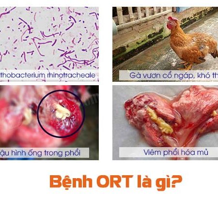 Tìm hiểu bệnh ORT và cách điều trị tại Daga388